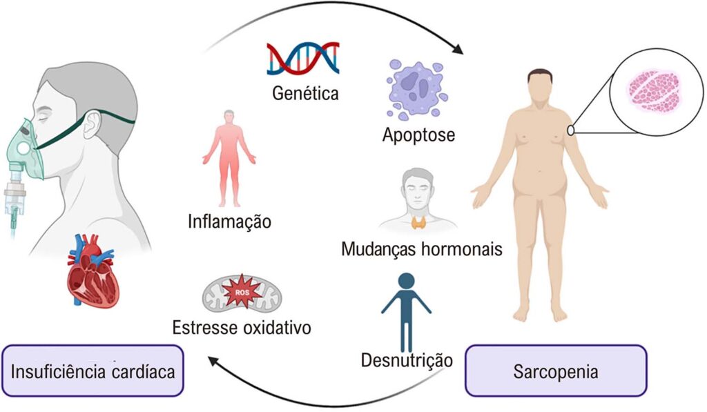 Como fugir da Sarcopenia